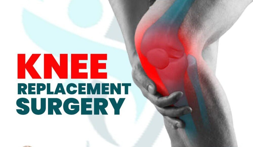 Dr. Ashraf Yousef Unit: Your Trusted Knee Replacement Experts
