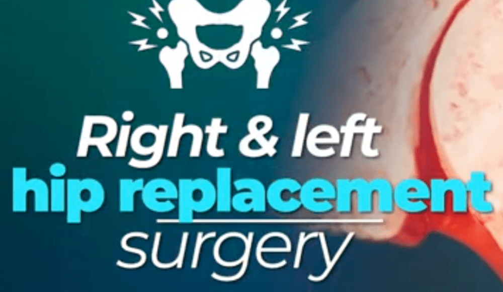 Patient Success Story, Hip Replacement: Kevin Bryan’s Journey to Mobility at Dr. Ashraf Yousef’s Clinic